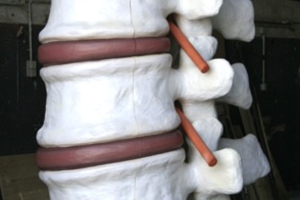 Anschauungsobjekt „Wirbelsäule“<span>Wirbelsäulenzentrum, Klinik Hannover<br>Styropor, Lack<br>Höhe: 2,00 m</span>